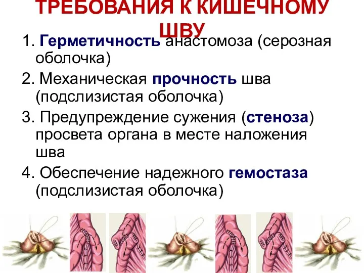 ТРЕБОВАНИЯ К КИШЕЧНОМУ ШВУ 1. Герметичность анастомоза (серозная оболочка) 2.