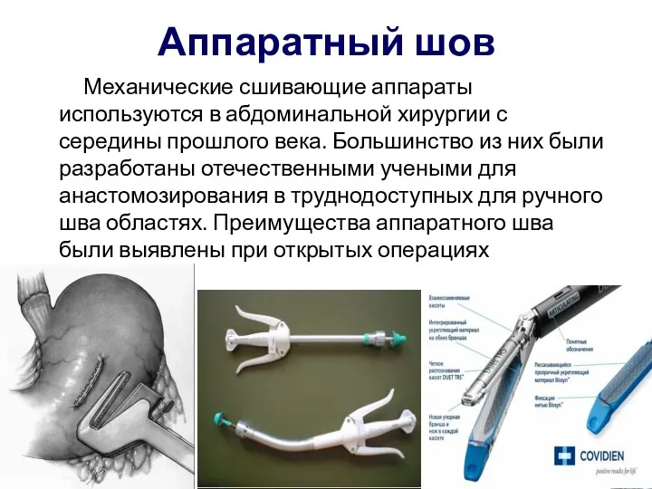 Аппаратный шов Механические сшивающие аппараты используются в абдоминальной хирургии с