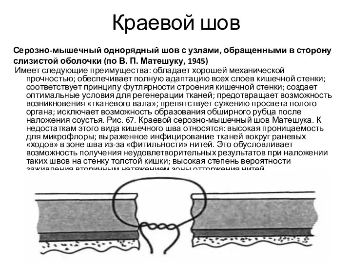 Имеет следующие преимущества: обладает хорошей механической прочностью; обеспечивает полную адаптацию всех слоев кишечной