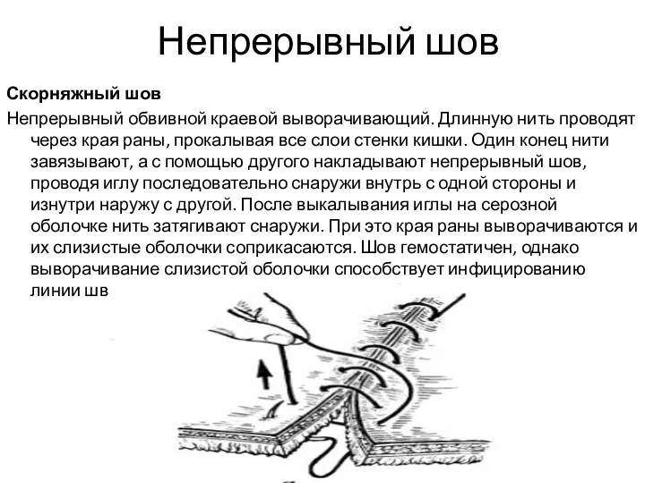 Непрерывный шов Скорняжный шов Непрерывный обвивной краевой выворачивающий. Длинную нить проводят через края