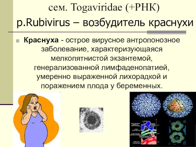 сем. Togaviridae (+РНК) Краснуха - острое вирусное антропонозное заболевание, характеризующаяся мелкопятнистой экзантемой, генерализованной
