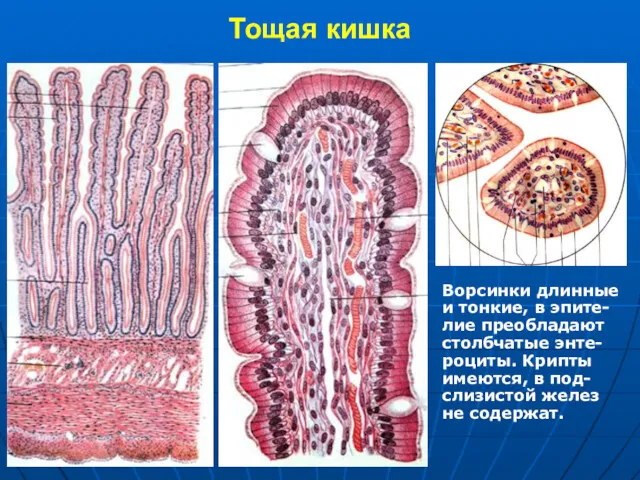 Тощая кишка Ворсинки длинные и тонкие, в эпите- лие преобладают