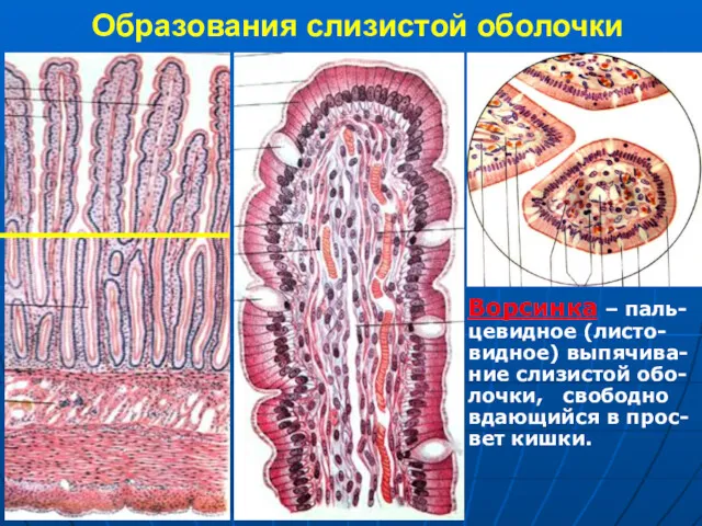 Образования слизистой оболочки Ворсинка – паль- цевидное (листо- видное) выпячива-