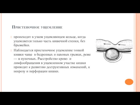 Пристеночное ущемление происходит в узком ущемляющем кольце, когда ущемляется только