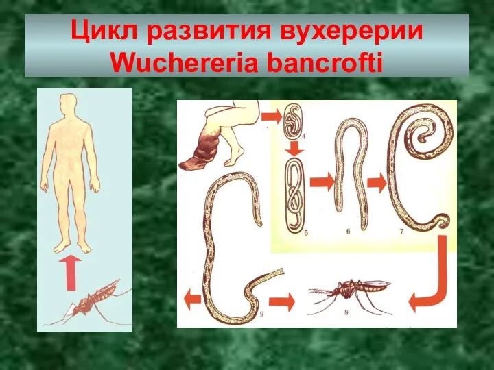 Цикл развития вухерерии Wuchereria bancrofti