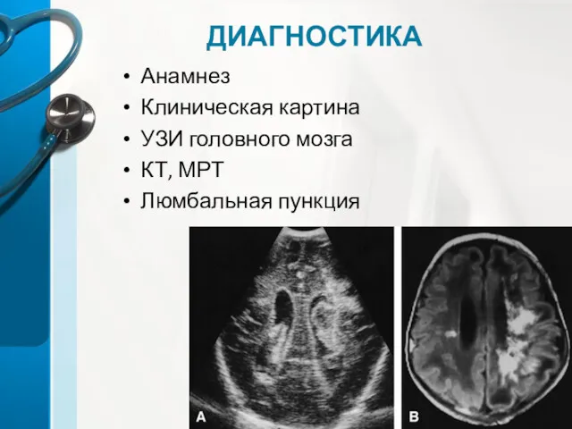 ДИАГНОСТИКА Анамнез Клиническая картина УЗИ головного мозга КТ, МРТ Люмбальная пункция
