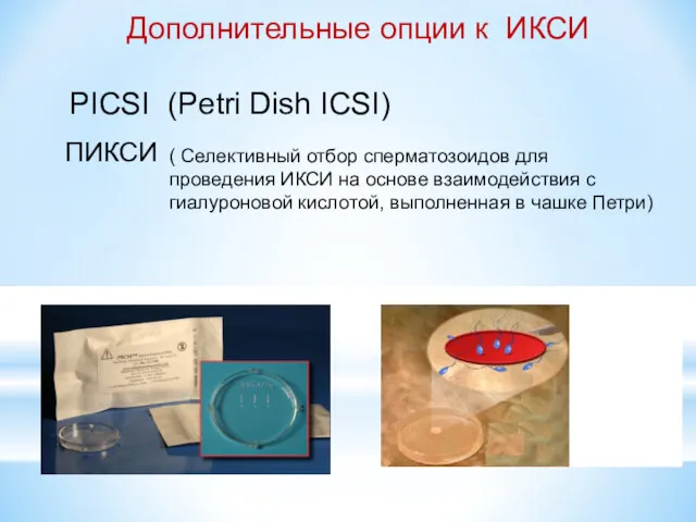 ПИКСИ ( Селективный отбор сперматозоидов для проведения ИКСИ на основе