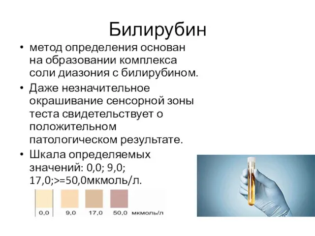 Билирубин метод определения основан на образовании комплекса соли диазония с