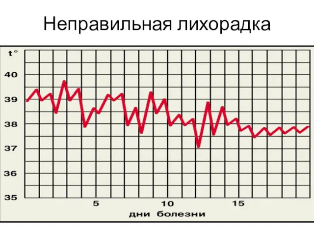 Неправильная лихорадка