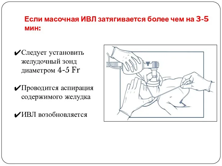 Если масочная ИВЛ затягивается более чем на 3-5 мин: Следует