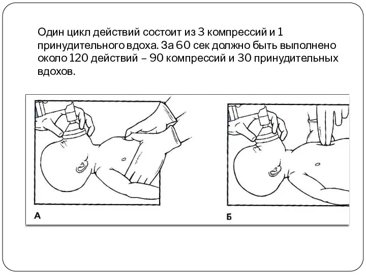 Один цикл действий состоит из 3 компрессий и 1 принудительного