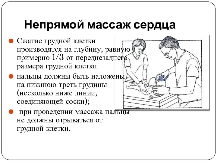 Непрямой массаж сердца Сжатие грудной клетки производятся на глубину, равную