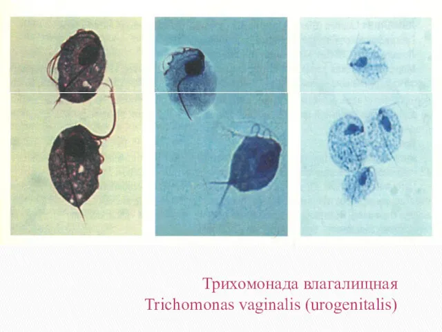 Трихомонада влагалищная Trichomonas vaginalis (urogenitalis)