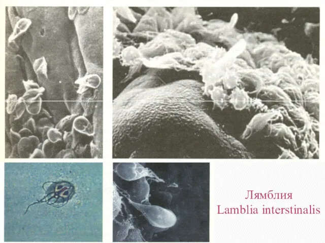 Лямблия Lamblia interstinalis