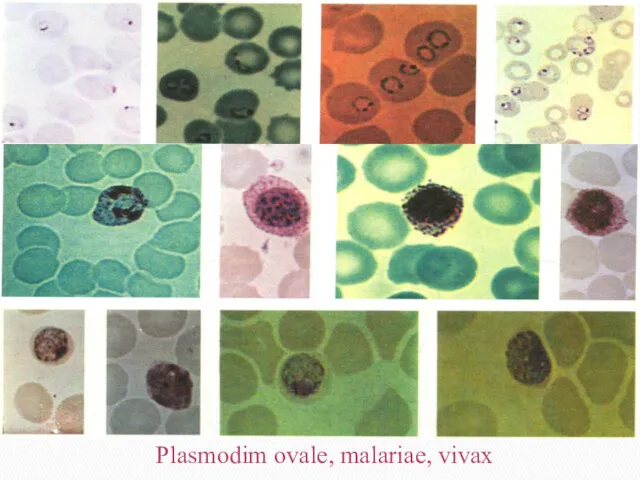 Plasmodim ovale, malariae, vivax