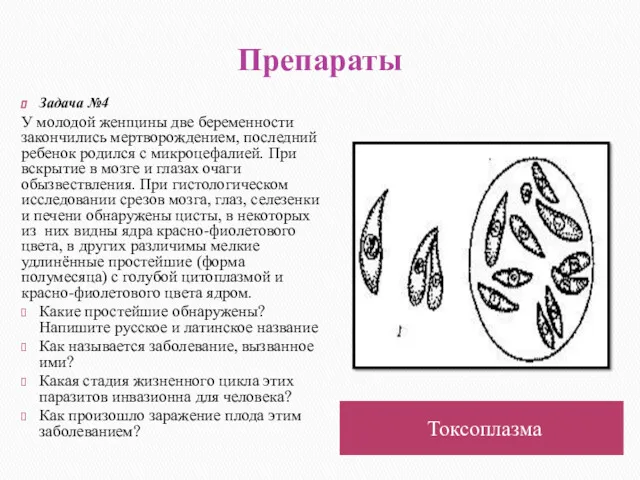 Препараты Токсоплазма Задача №4 У молодой женщины две беременности закончились