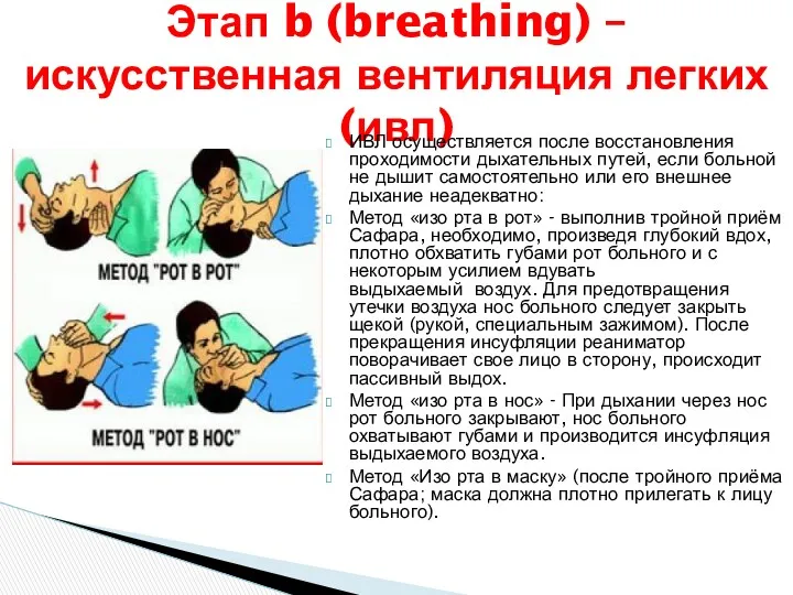 Этап b (breathing) – искусственная вентиляция легких (ивл) ИВЛ осуществляется