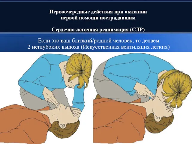 Первоочередные действия при оказании первой помощи пострадавшим Сердечно-легочная реанимация (СЛР)