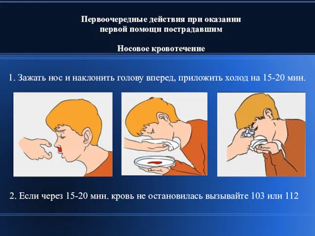 Первоочередные действия при оказании первой помощи пострадавшим Носовое кровотечение 1.