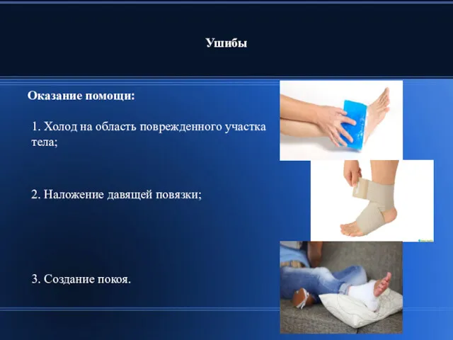 Ушибы Оказание помощи: 2. Наложение давящей повязки; 3. Создание покоя.