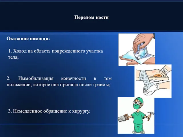 Перелом кости Оказание помощи: 2. Иммобилизация конечности в том положении,