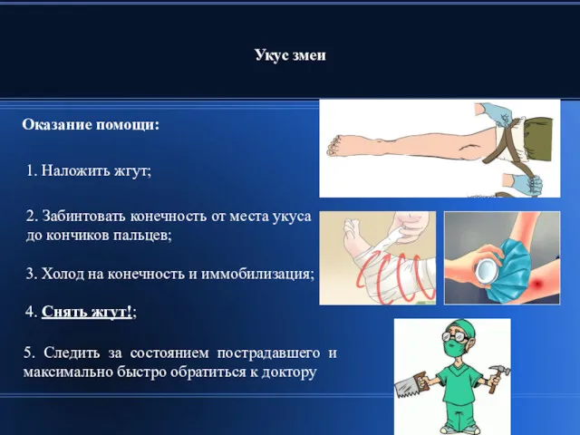 Укус змеи 2. Забинтовать конечность от места укуса до кончиков