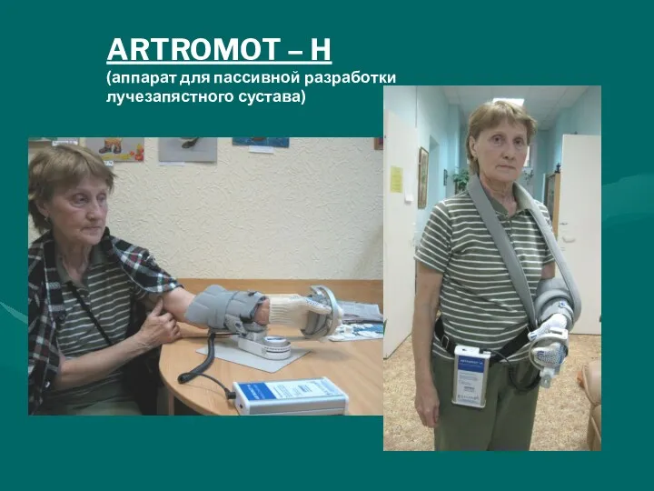 ARTROMOT – H (аппарат для пассивной разработки лучезапястного сустава)