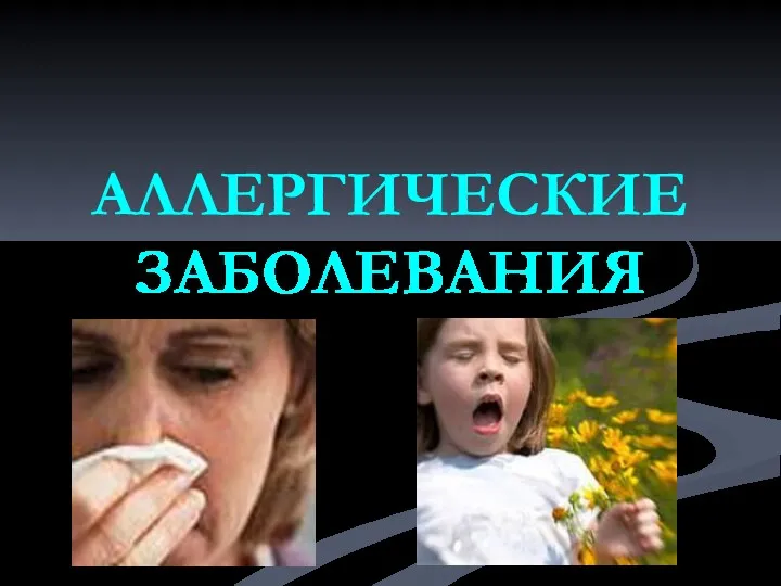 Аллергические заболевания