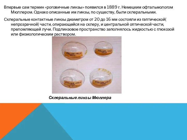 Впервые сам термин «роговичные линзы» появился в 1889 г. Немецким офтальмологом Мюллером. Однако