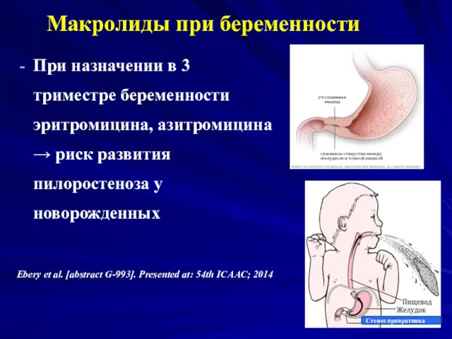 Макролиды при беременности При назначении в 3 триместре беременности эритромицина,