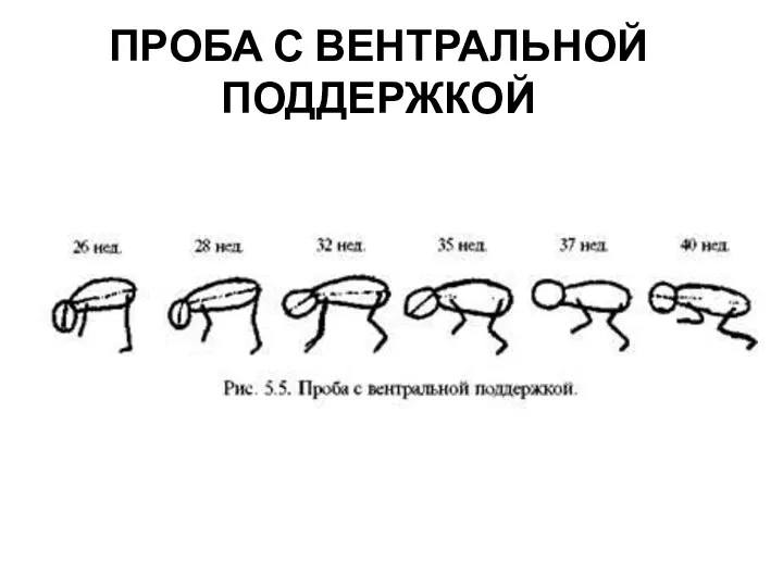 ПРОБА С ВЕНТРАЛЬНОЙ ПОДДЕРЖКОЙ