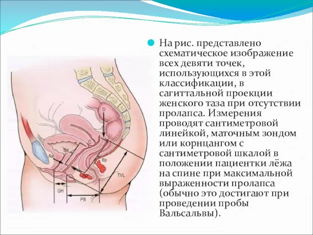 На рис. представлено схематическое изображение всех девяти точек, использующихся в