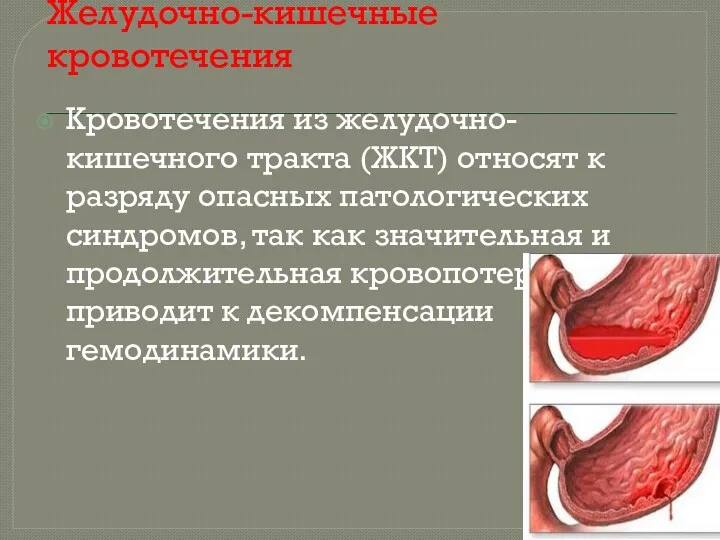 Желудочно-кишечные кровотечения Кровотечения из желудочно-кишечного тракта (ЖКТ) относят к разряду