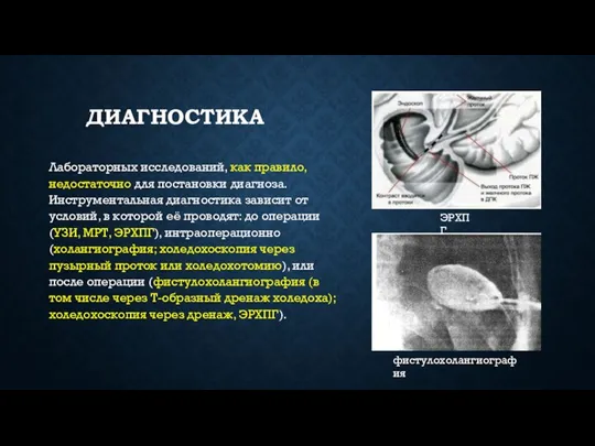 ДИАГНОСТИКА Лабораторных исследований, как правило, недостаточно для постановки диагноза. Инструментальная