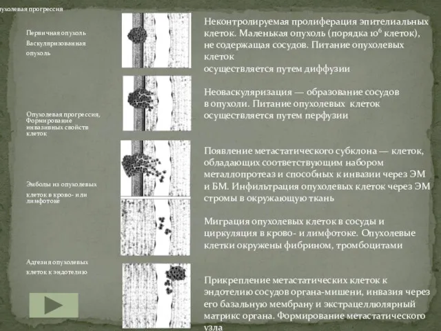 Первичная опухоль Васкуляризованная опухоль Опухолевая прогрессия, Формирование инвазивных свойств клеток