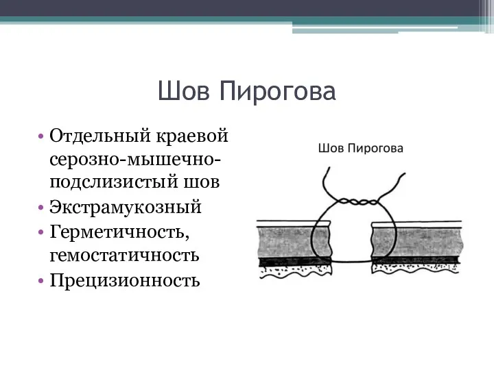 Шов Пирогова Отдельный краевой серозно-мышечно-подслизистый шов Экстрамукозный Герметичность, гемостатичность Прецизионность