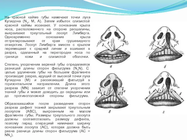 На красной кайме губы намечают точки лука Купидона (N1, М,