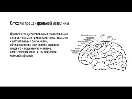 Опухоли прецентральной извилины Проявляются джексоновскими двигательными и оперкулярными припадками (жевательными