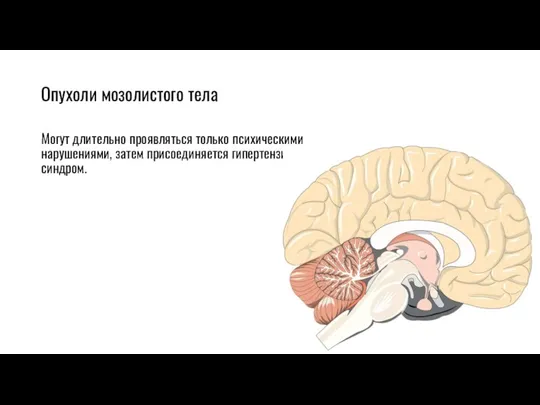 Опухоли мозолистого тела Могут длительно проявляться только психическими нарушениями, затем присоединяется гипертензивный синдром.