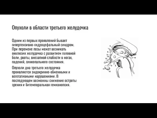 Опухоли в области третьего желудочка Одним из первых проявлений бывает