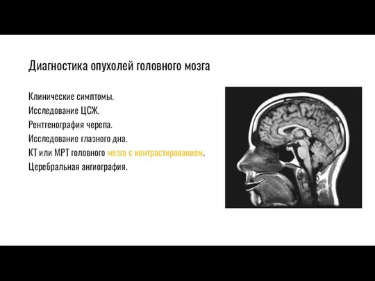 Диагностика опухолей головного мозга Клинические симптомы. Исследование ЦСЖ. Рентгенография черепа.