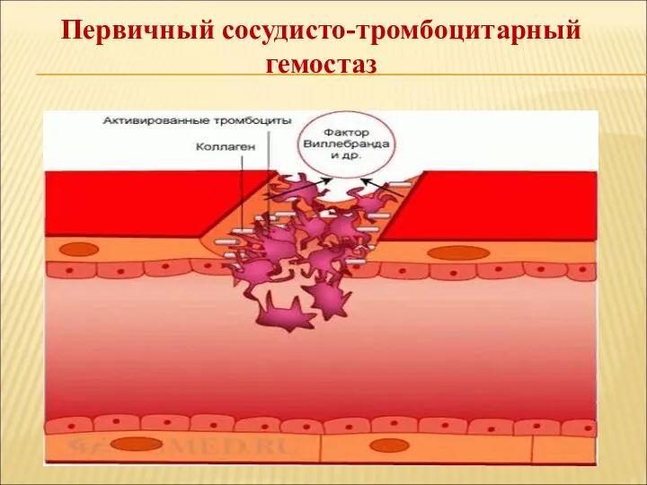 Первичный сосудисто-тромбоцитарный гемостаз