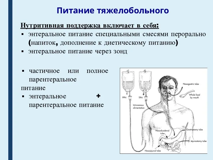 Питание тяжелобольного Нутритивная поддержка включает в себя: энтеральное питание специальными