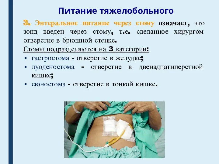 Питание тяжелобольного 3. Энтеральное питание через стому означает, что зонд