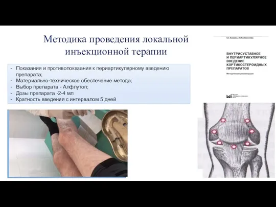 Методика проведения локальной инъекционной терапии Показания и противопоказания к периартикулярному