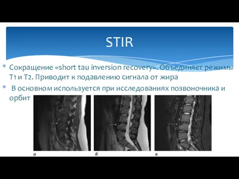 Сокращение «short tau inversion recovery». Объединяет режимы Т1 и Т2.