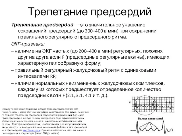 Трепетание предсердий Трепетание предсердий — это значительное учащение сокращений предсердий