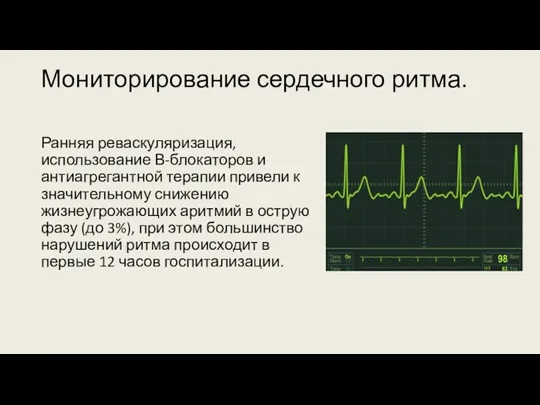 Мониторирование сердечного ритма. Ранняя реваскуляризация, использование В-блокаторов и антиагрегантной терапии
