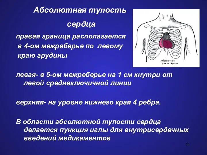 Абсолютная тупость сердца правая граница располагается в 4-ом межреберье по