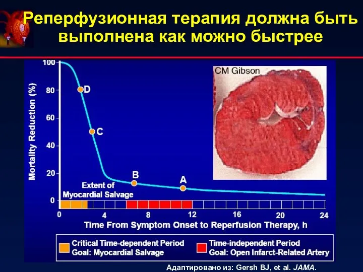 Реперфузионная терапия должна быть выполнена как можно быстрее Адаптировано из: Gersh BJ, et al. JAMA. 2005;293:979.